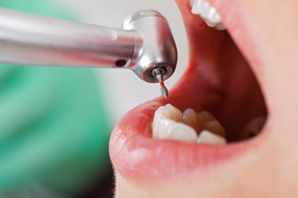 Best Urgent Tooth Repair  in Lake Orion, MI